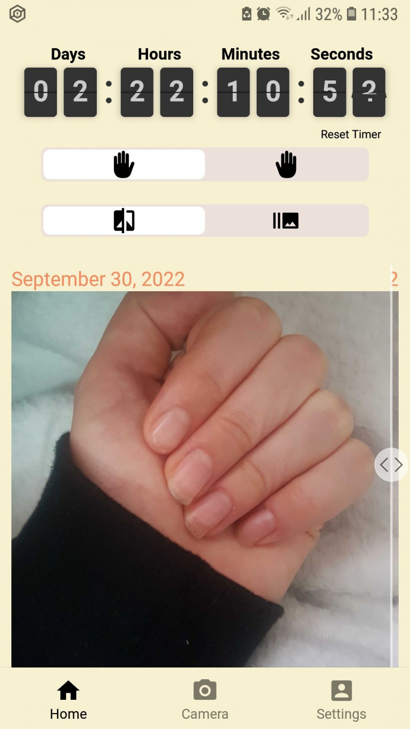   Aplicació mòbil NailKeeper deixa de mossegar-se les ungles